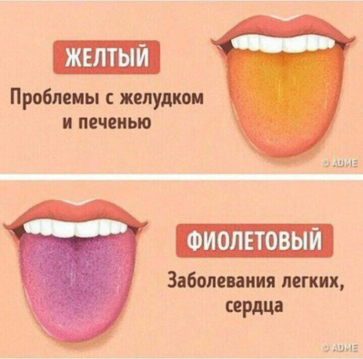 ​Жовтий або фіолетовий наліт на язиці