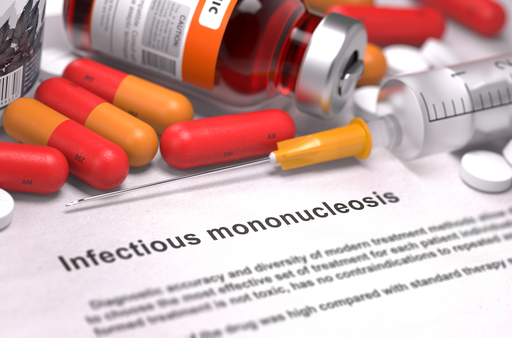 Инфекционный мононуклеоз: симптомы и лечение