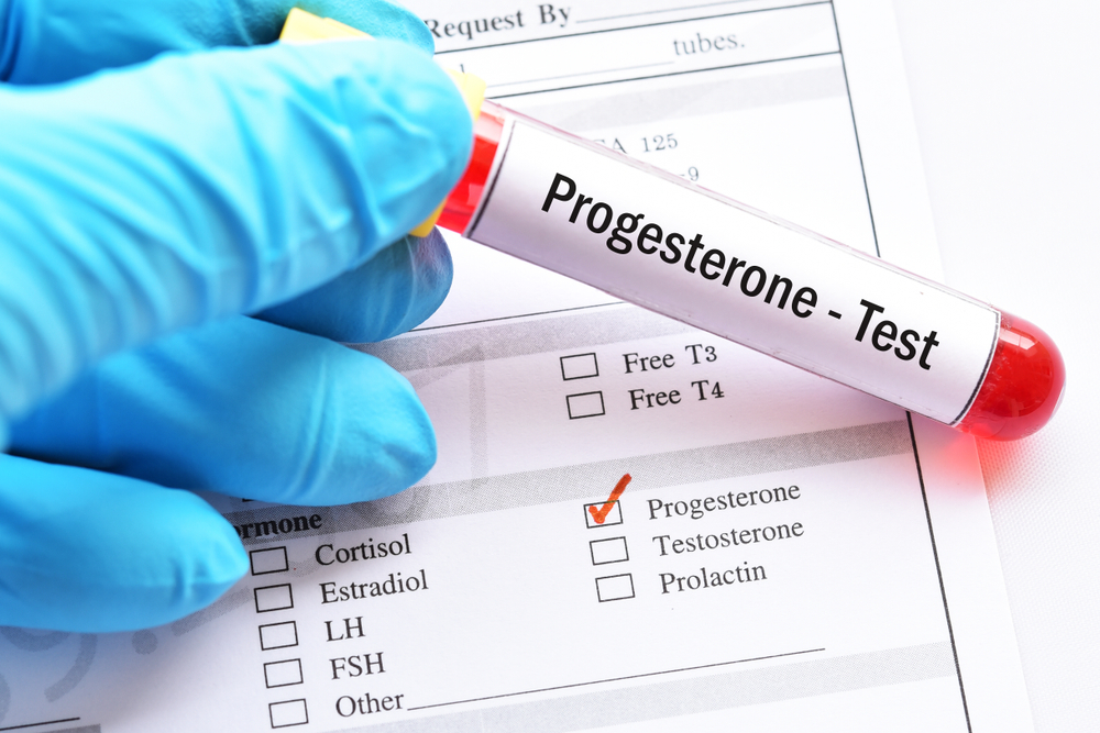 Анализ на прогестерон
