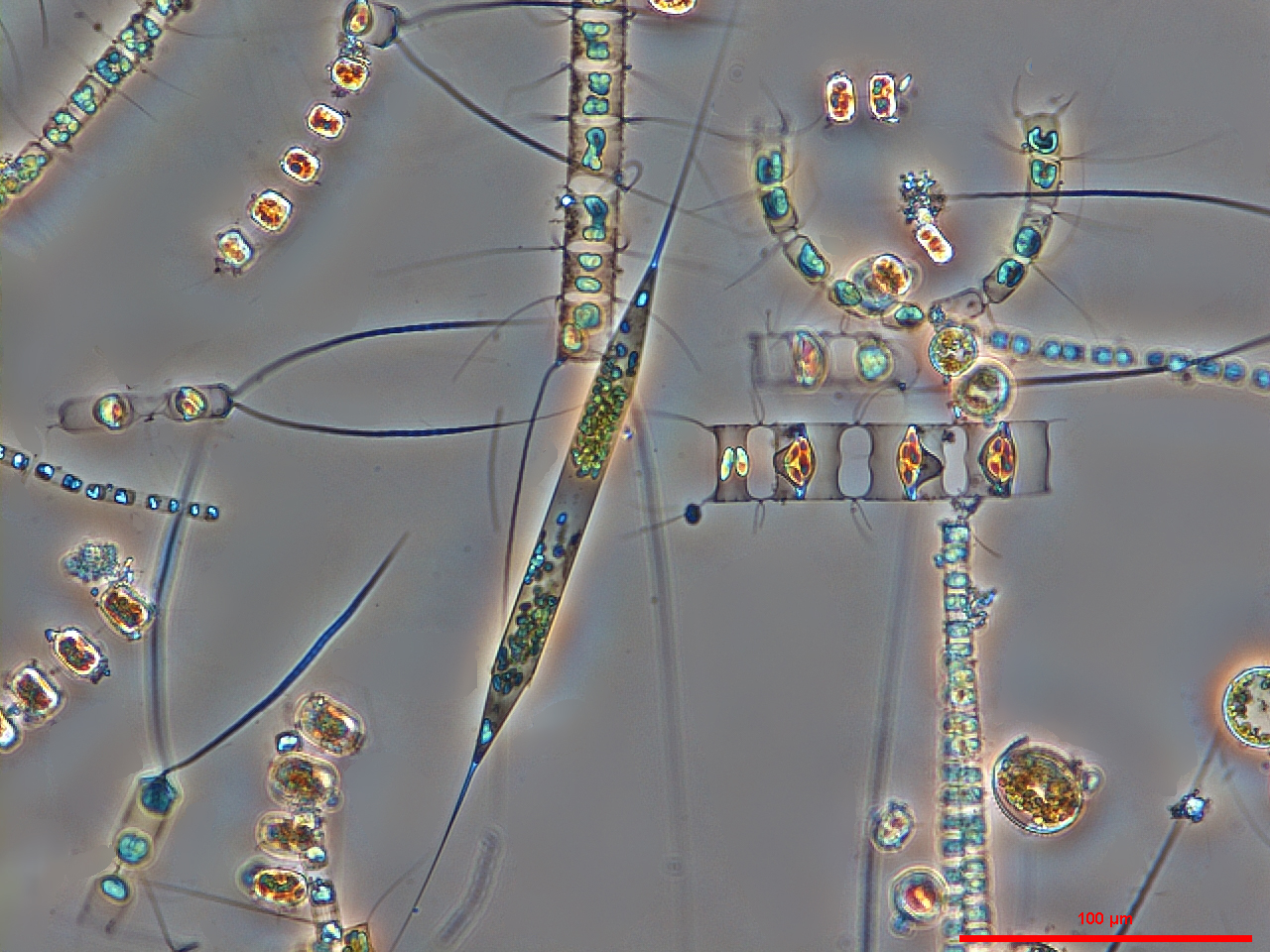 Микроорганизмы под микроскопом