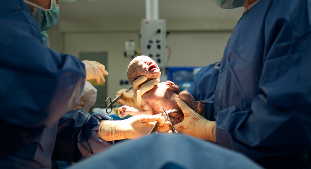 Психическое здоровье новорожденного при бережном кесаревом сечении не пострадает 