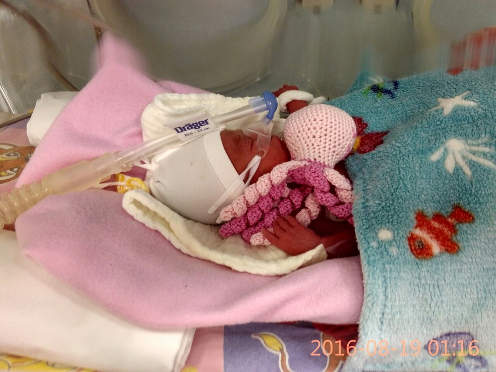 Недоношенный малыш в инкубаторе